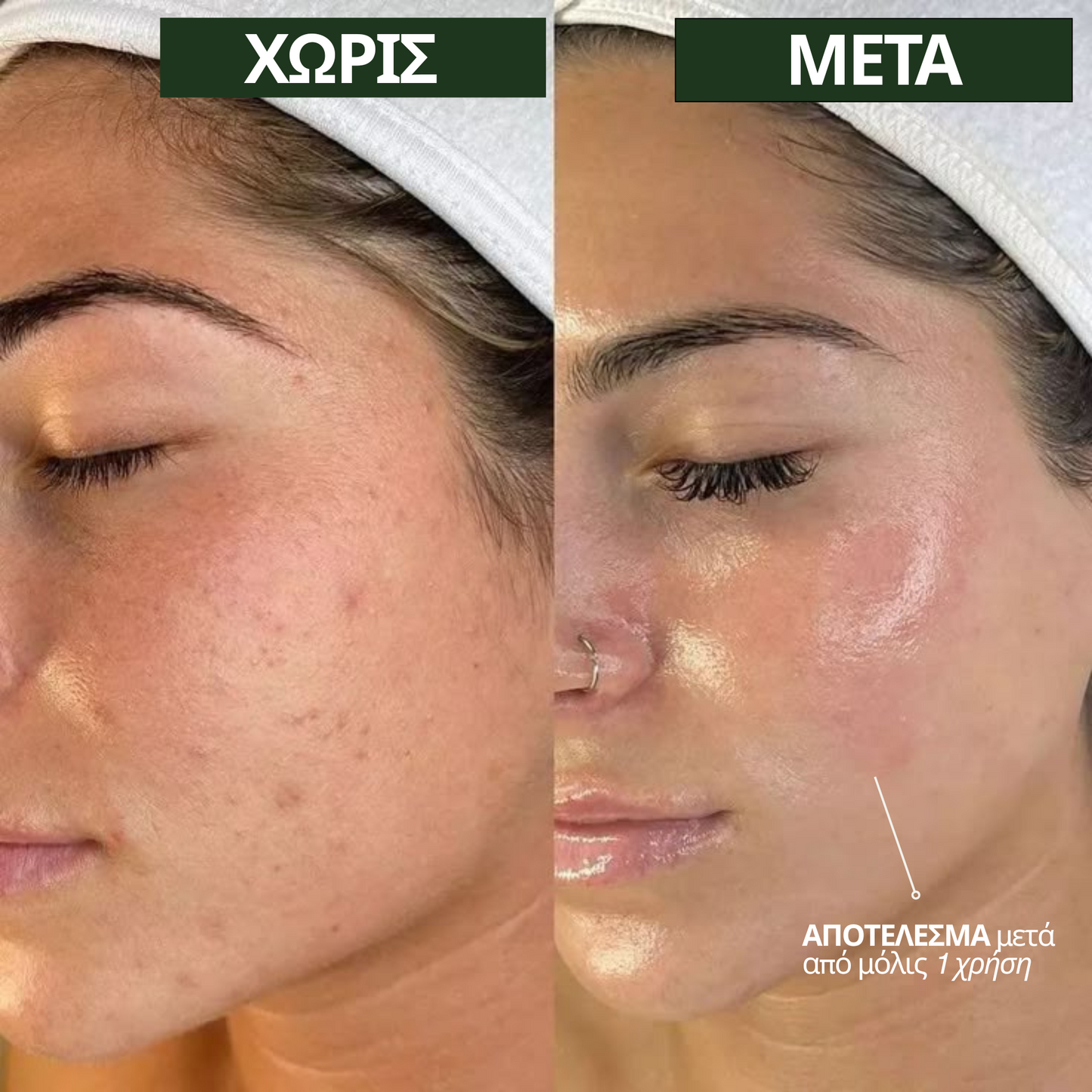 Bio-Collagen Mask